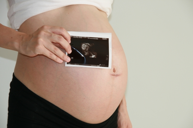 妊娠　妊婦　マタニティ　超音波写真　エコー写真